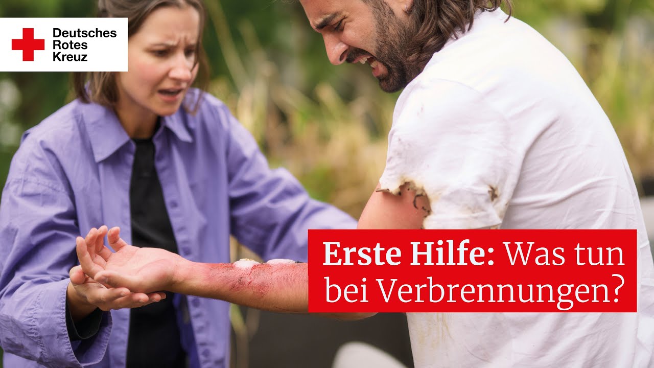 Erste Hilfe: Was tun bei Verbrennungen?